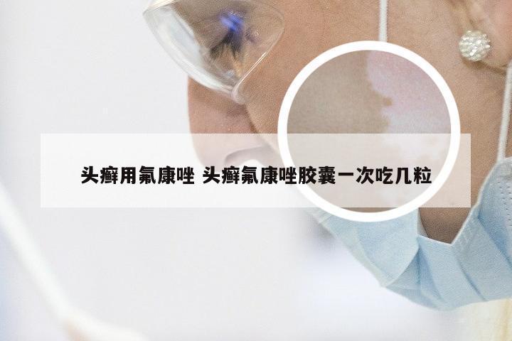 头癣用氟康唑 头癣氟康唑胶囊一次吃几粒