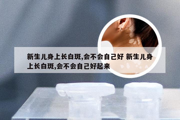 新生儿身上长白斑,会不会自己好 新生儿身上长白斑,会不会自己好起来