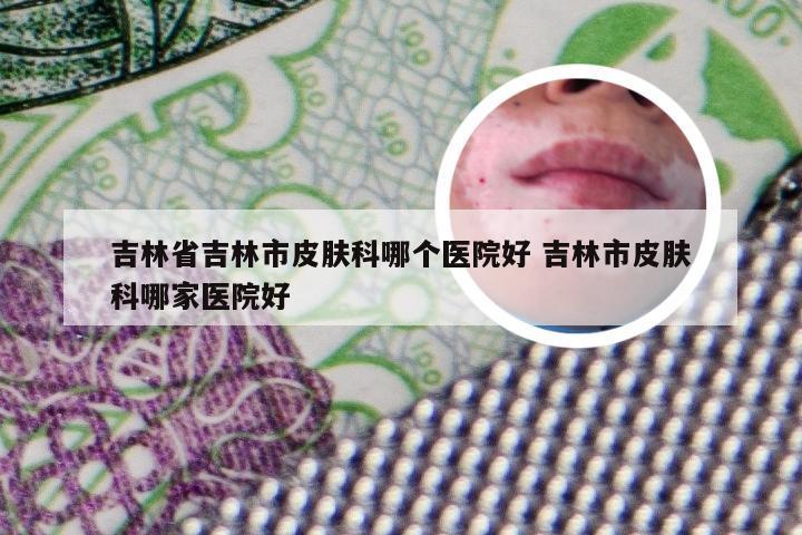 吉林省吉林市皮肤科哪个医院好 吉林市皮肤科哪家医院好