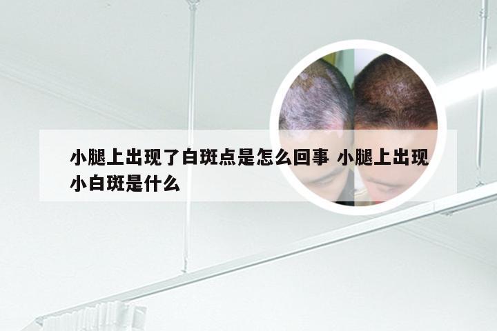 小腿上出现了白斑点是怎么回事 小腿上出现小白斑是什么