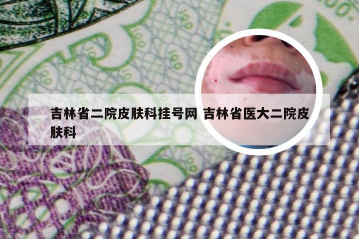 吉林省二院皮肤科挂号网 吉林省医大二院皮肤科