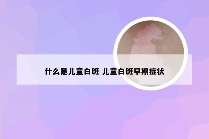 什么是儿童白斑 儿童白斑早期症状