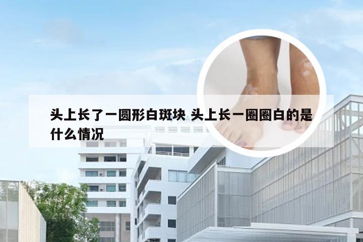 头上长了一圆形白斑块 头上长一圈圈白的是什么情况