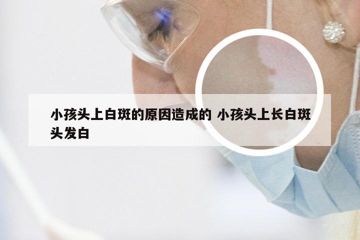 小孩头上白斑的原因造成的 小孩头上长白斑头发白