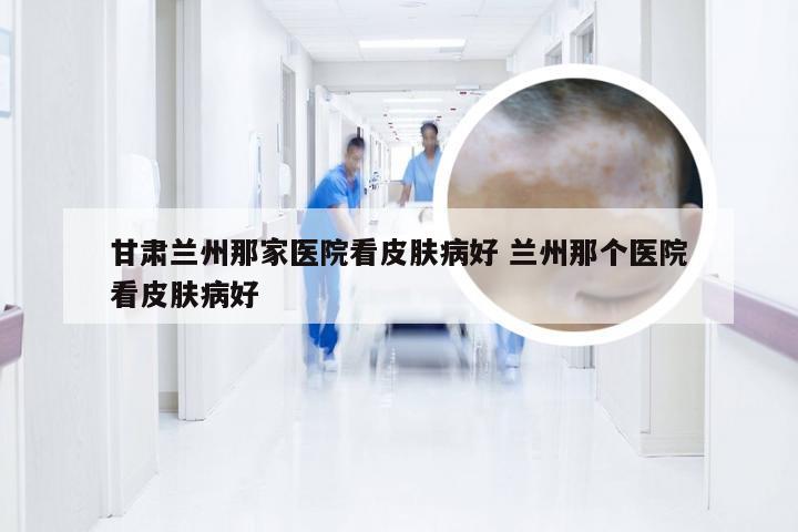 甘肃兰州那家医院看皮肤病好 兰州那个医院看皮肤病好