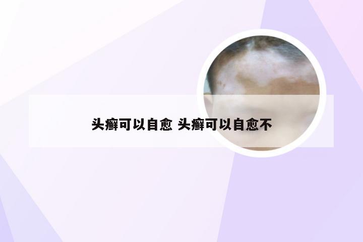 头癣可以自愈 头癣可以自愈不