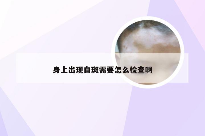 身上出现白斑需要怎么检查啊