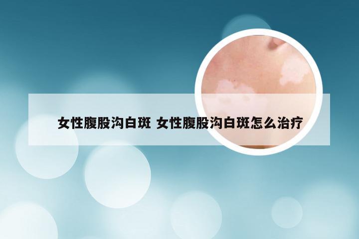 女性腹股沟白斑 女性腹股沟白斑怎么治疗