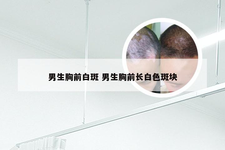 男生胸前白斑 男生胸前长白色斑块