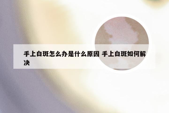 手上白斑怎么办是什么原因 手上白斑如何解决