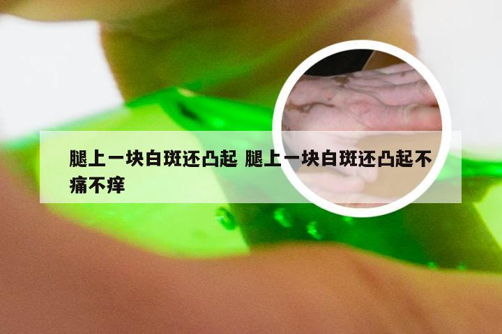 腿上一块白斑还凸起 腿上一块白斑还凸起不痛不痒