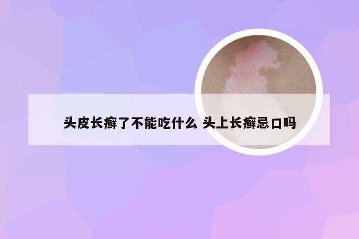 头皮长癣了不能吃什么 头上长癣忌口吗