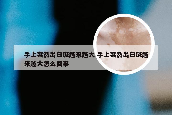 手上突然出白斑越来越大 手上突然出白斑越来越大怎么回事