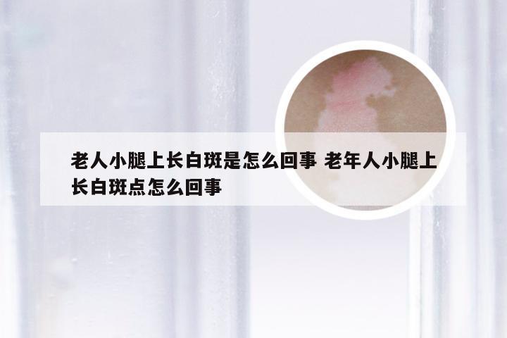 老人小腿上长白斑是怎么回事 老年人小腿上长白斑点怎么回事