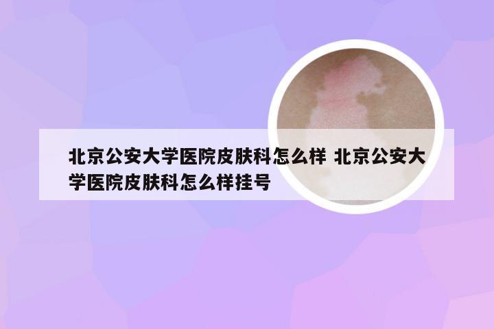 北京公安大学医院皮肤科怎么样 北京公安大学医院皮肤科怎么样挂号