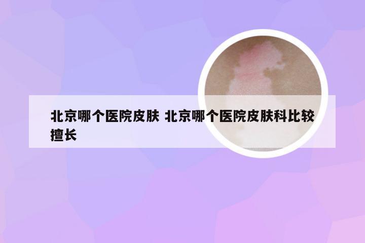 北京哪个医院皮肤 北京哪个医院皮肤科比较擅长