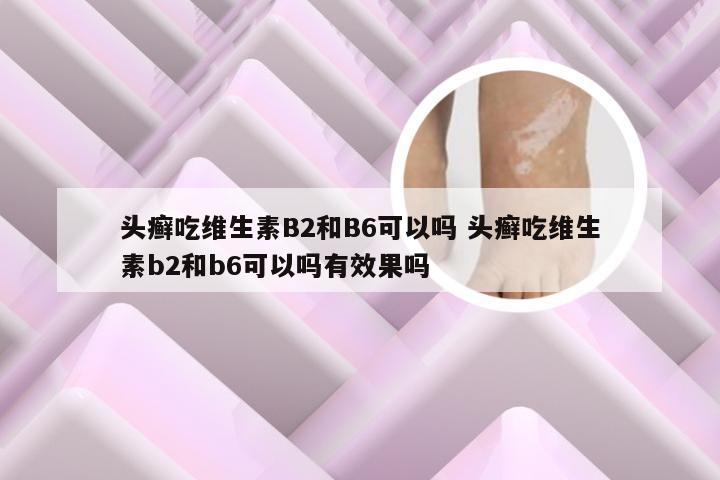 头癣吃维生素B2和B6可以吗 头癣吃维生素b2和b6可以吗有效果吗