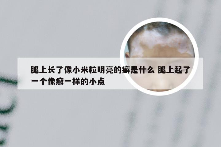 腿上长了像小米粒明亮的癣是什么 腿上起了一个像癣一样的小点