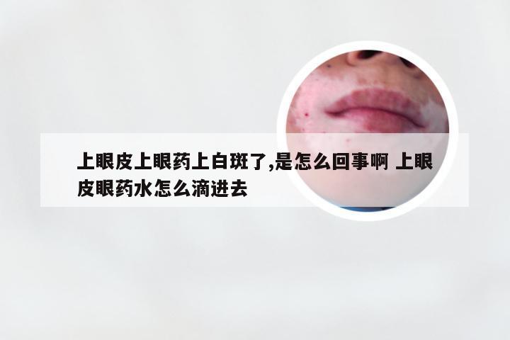 上眼皮上眼药上白斑了,是怎么回事啊 上眼皮眼药水怎么滴进去