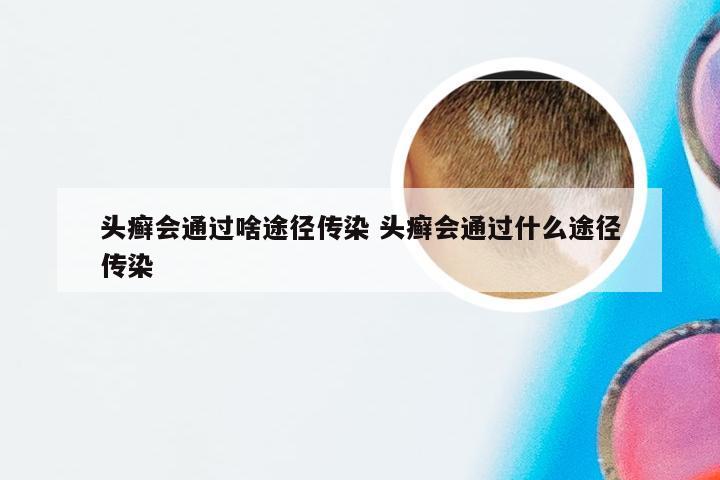 头癣会通过啥途径传染 头癣会通过什么途径传染