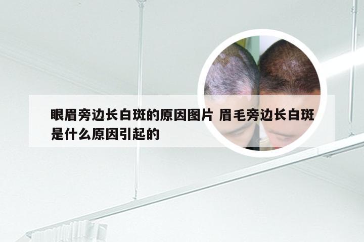 眼眉旁边长白斑的原因图片 眉毛旁边长白斑是什么原因引起的