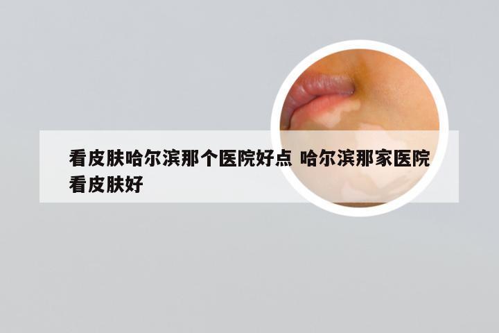 看皮肤哈尔滨那个医院好点 哈尔滨那家医院看皮肤好