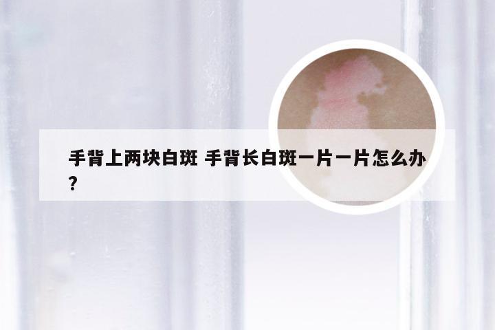 手背上两块白斑 手背长白斑一片一片怎么办?