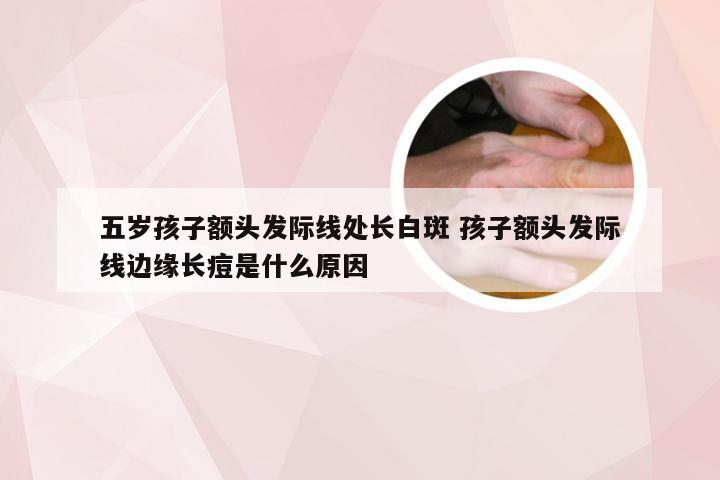 五岁孩子额头发际线处长白斑 孩子额头发际线边缘长痘是什么原因