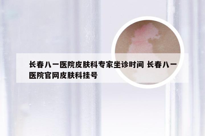 长春八一医院皮肤科专家坐诊时间 长春八一医院官网皮肤科挂号