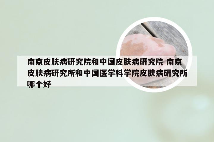 南京皮肤病研究院和中国皮肤病研究院 南京皮肤病研究所和中国医学科学院皮肤病研究所哪个好