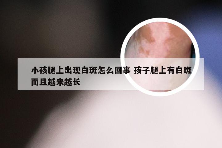 小孩腿上出现白斑怎么回事 孩子腿上有白斑而且越来越长