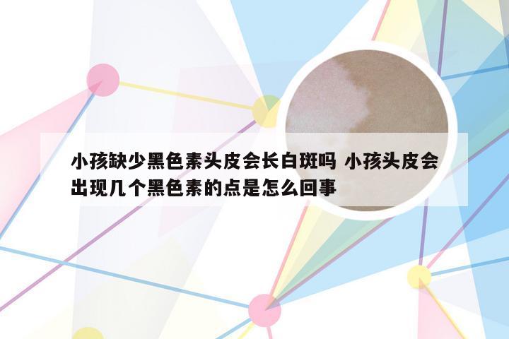 小孩缺少黑色素头皮会长白斑吗 小孩头皮会出现几个黑色素的点是怎么回事