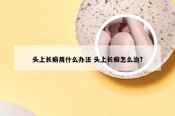 头上长癣用什么办法 头上长癣怎么治?