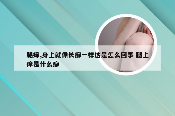 腿痒,身上就像长癣一样这是怎么回事 腿上痒是什么癣