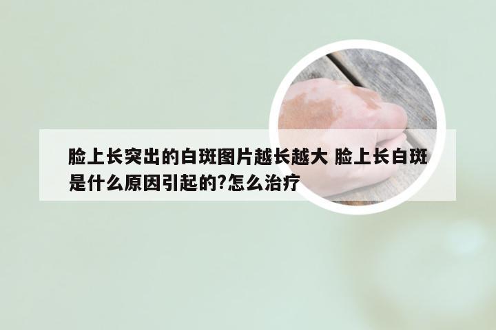 脸上长突出的白斑图片越长越大 脸上长白斑是什么原因引起的?怎么治疗