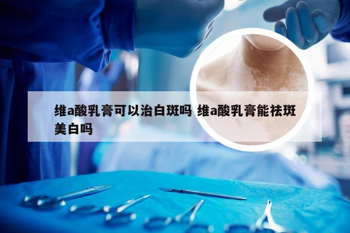 维a酸乳膏可以治白斑吗 维a酸乳膏能祛斑美白吗