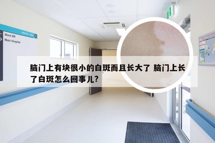 脑门上有块很小的白斑而且长大了 脑门上长了白斑怎么回事儿?