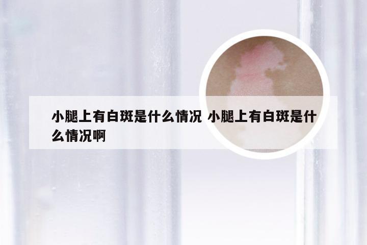 小腿上有白斑是什么情况 小腿上有白斑是什么情况啊