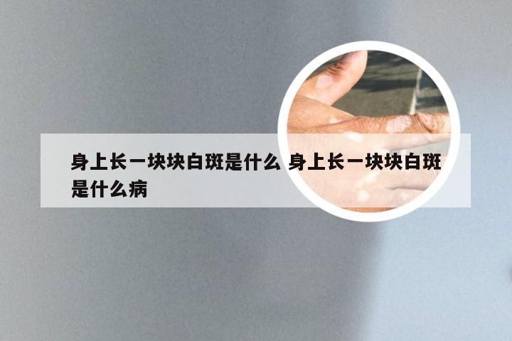 身上长一块块白斑是什么 身上长一块块白斑是什么病