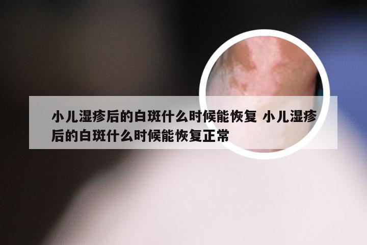 小儿湿疹后的白斑什么时候能恢复 小儿湿疹后的白斑什么时候能恢复正常