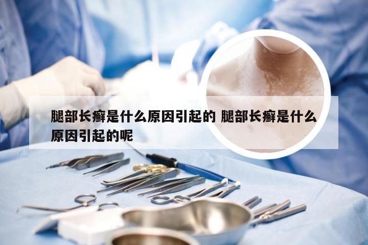 腿部长癣是什么原因引起的 腿部长癣是什么原因引起的呢