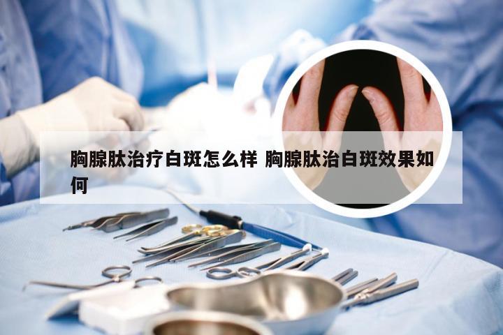 胸腺肽治疗白斑怎么样 胸腺肽治白斑效果如何