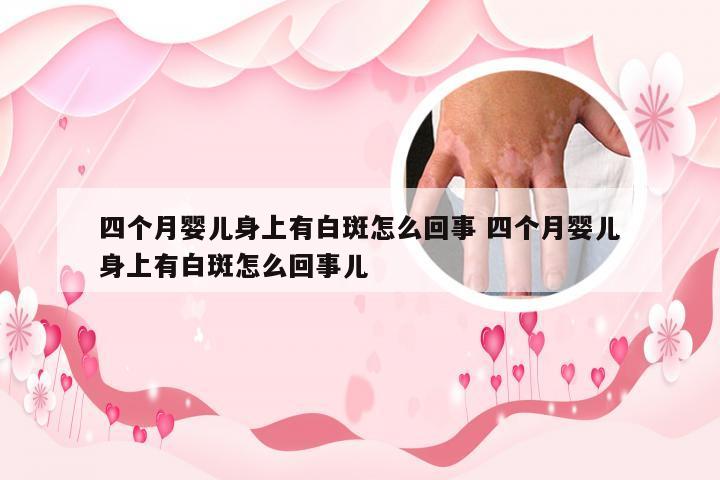 四个月婴儿身上有白斑怎么回事 四个月婴儿身上有白斑怎么回事儿