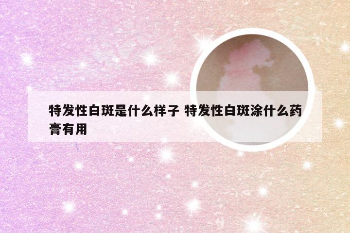 特发性白斑是什么样子 特发性白斑涂什么药膏有用