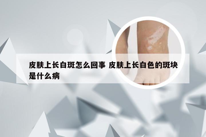 皮肤上长白斑怎么回事 皮肤上长白色的斑块是什么病