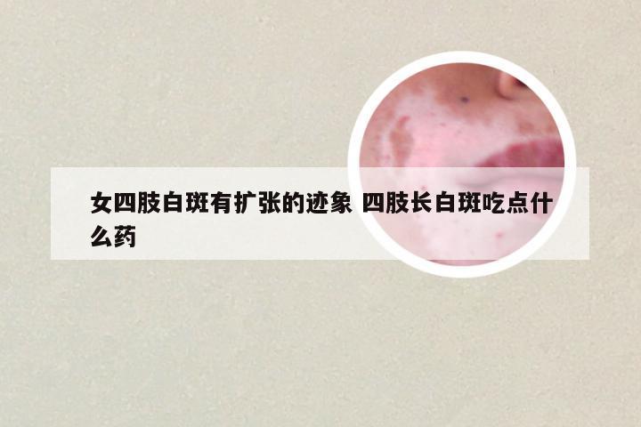 女四肢白斑有扩张的迹象 四肢长白斑吃点什么药