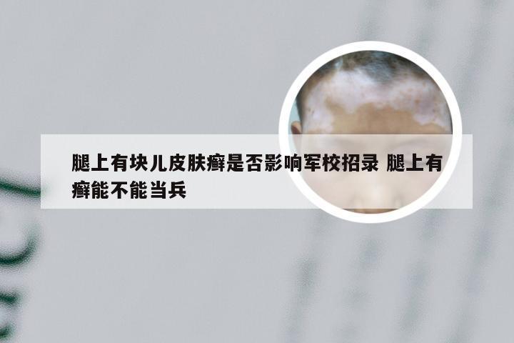 腿上有块儿皮肤癣是否影响军校招录 腿上有癣能不能当兵