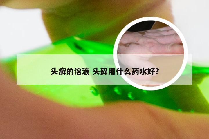 头癣的溶液 头藓用什么药水好?