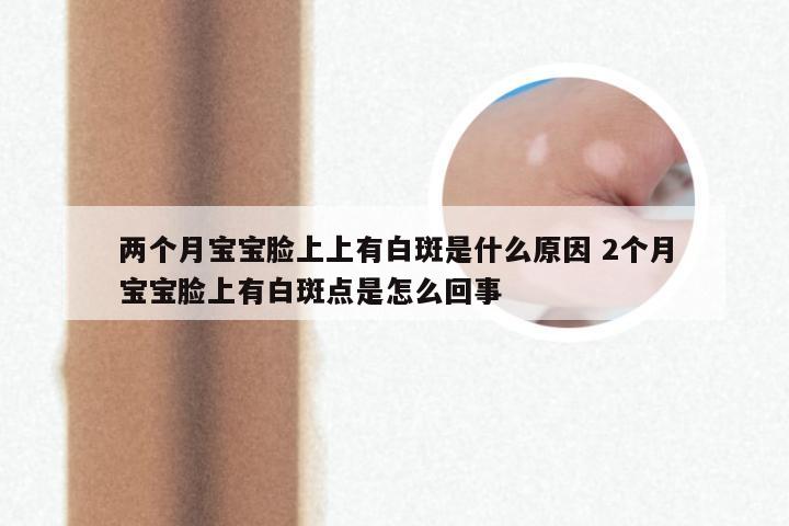 两个月宝宝脸上上有白斑是什么原因 2个月宝宝脸上有白斑点是怎么回事