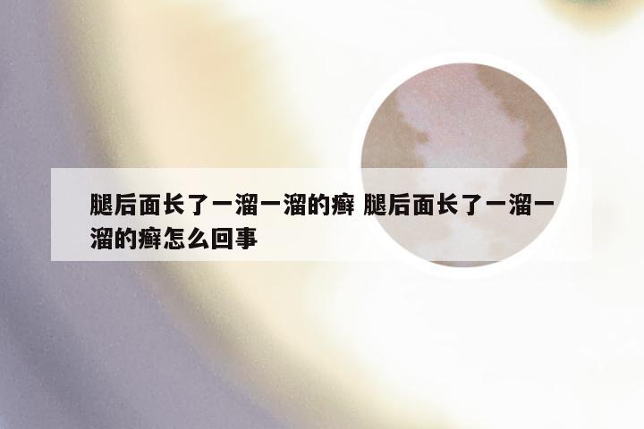 腿后面长了一溜一溜的癣 腿后面长了一溜一溜的癣怎么回事